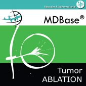 Logo Tumor Ablation